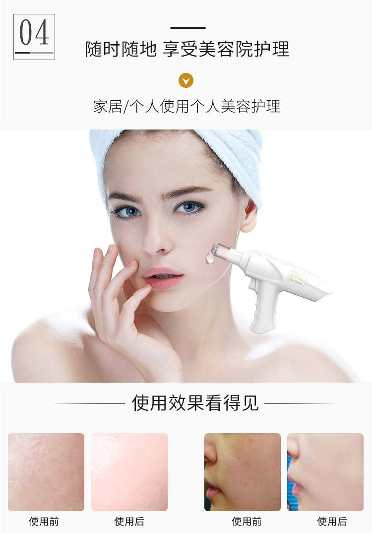 纳米微晶导入仪-详情_09